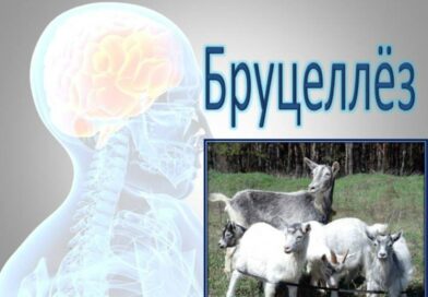 Бруцеллез